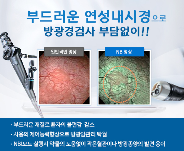유로센터비뇨기과 연성내시경
