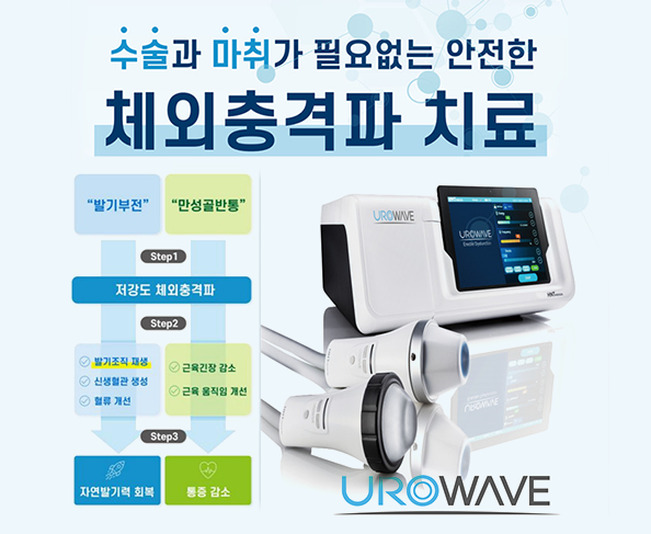 체외충격파치료