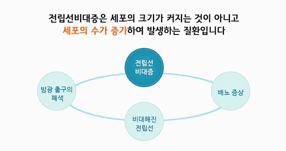 전립선비대증은 세포의 크기가 커지는 것이 아니고 세포의 수가 증가하여 발생하는 질환입니다